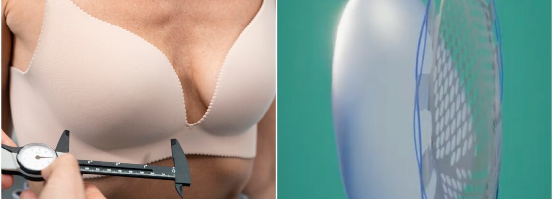 reconstrução mamária