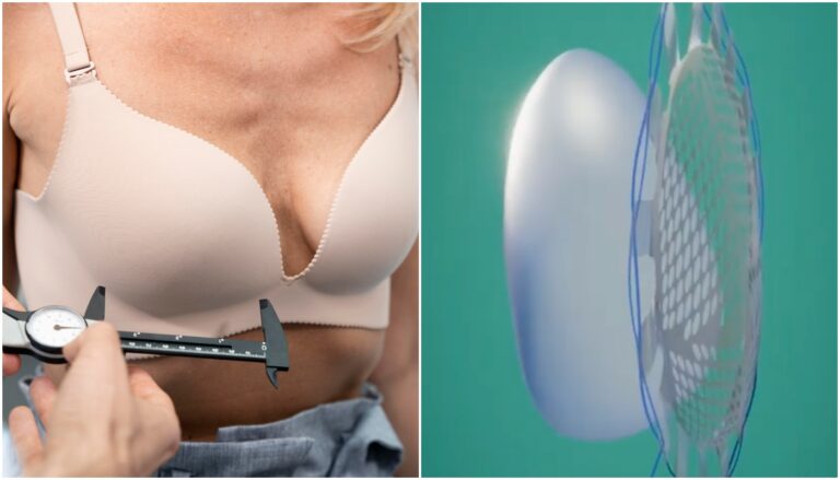 reconstrução mamária