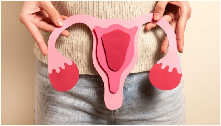 síndrome dos ovários policísticos